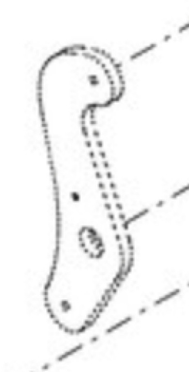 Case 87344111 - Suspension for Construction machinery: picture 2 Case 87344111 - Suspension for Construction machinery: picture 2
